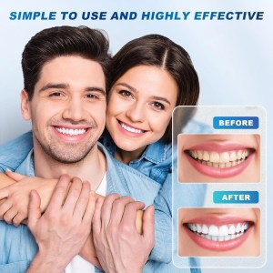 Whiter teeth